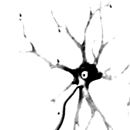 Otto Deiters’ 1865 drawing of a neuron